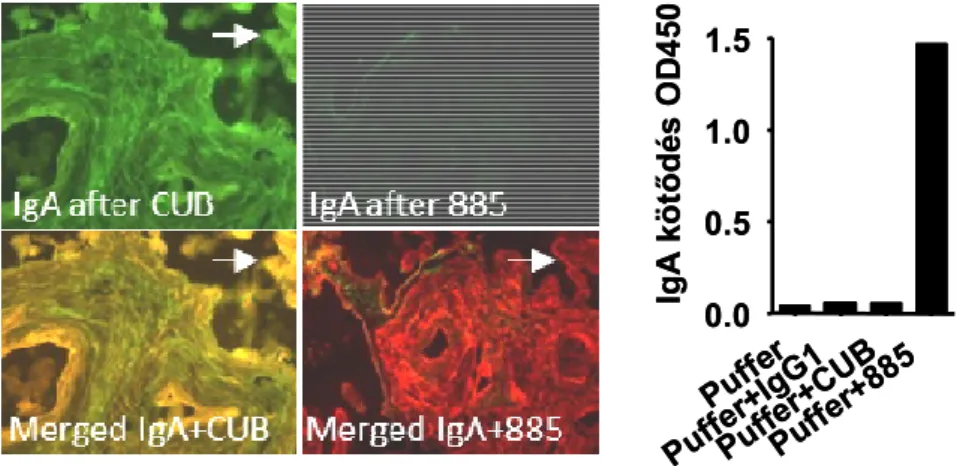 34. ábra. Coeliakiás placenta szövetben lerakódott IgA antitestek (zöld) CUB7402 vagy MAb 885 monoklonális  egér TG2 antitestek (piros) hozzáadása után