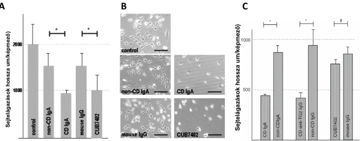 45. ábra. A coeliakia-specifikus IgA, IgG antitestek és egér monoklonális anti-TG2 antitestek (CUB7402) hatása   endothél-mesenchymális sejtek együttes (A,B) tenyésztése során a képzett érformációk  hosszára (A), a sejtek  migrációjára  (B)  és  csak  endo