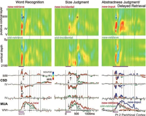 Fig. 3. Perirhinal activity during memory tasks. Words evoke an initial sharp middle layer transmembrane current sink (a) and superficial source (aV), seen in the CSD color maps (upper two rows) and waveforms (middle two rows)