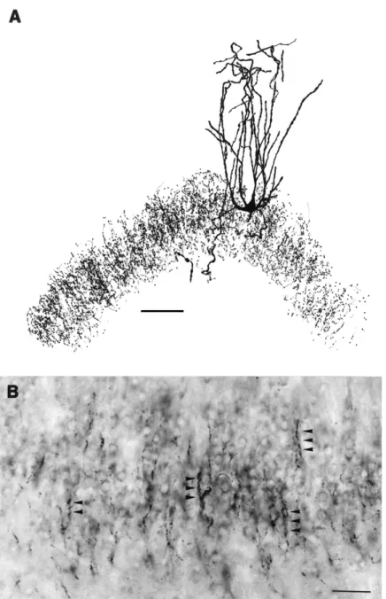 5. Ábra. PV-immunfestett sejt camera lucida rajza szklerotikus epilepsziás emberi gyrus  dentatusból (A), ugyanaz ami a 4