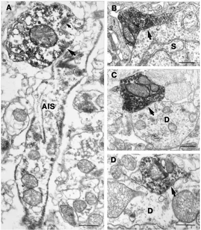 7. Ábra. PV-immunfestett axonterminálisok szimmetrikus szinapszist alkotnak epilepsziás  gyrus dentatusban szemcsesejtek axon iniciális szegmentumán (A), sejttestjén (B), dendritjén  (C) és ritkán interneuronk dendritjén is (D)