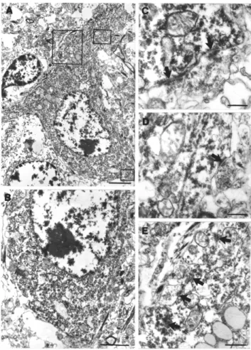 11. Ábra. Kontroll hilusból származó CB-immunfestett interneuron sejttestje, rövid dendritjei  és az azokat borító szinapszisok (C,D,E nyilak)