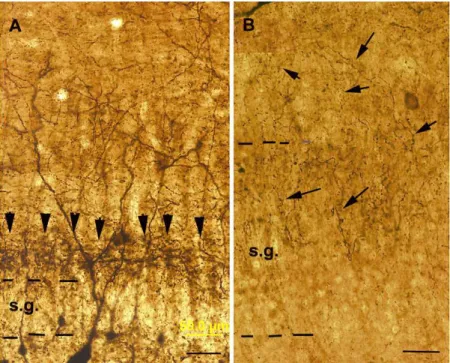 20. Ábra. CR-immunfestett metszetek fénymikroszkópos képe a gyrus dentatusból. A képen  megfigyelhető a supramammillaris, CR-tartalmú pálya végződése a szemcsesejtréteg (A, s.g.)  fölött, nyílhegyek