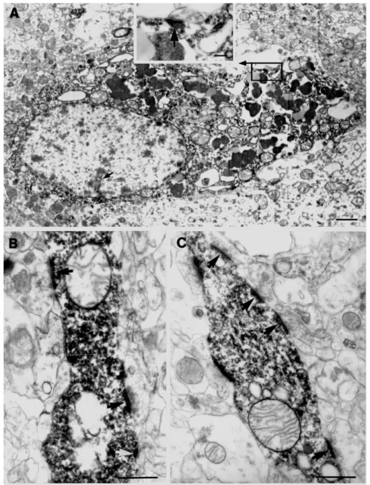 35. Ábra: Kontroll CA1 régióból zármazó interneuron sejttest (A) és dendritek  szinaptikus bemenetei láthatók a képen (B, C)