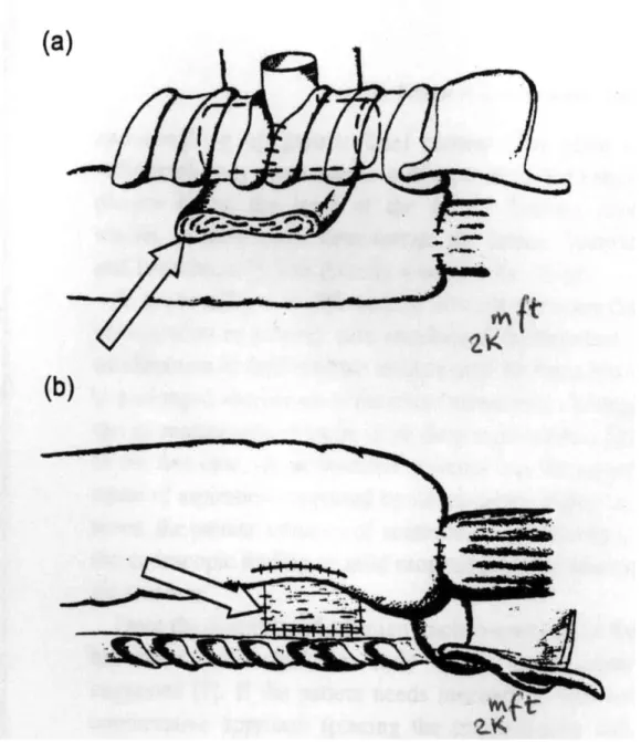 29. ábra: a légcső és az oesophagus varratát izomsál választja el egymástól 
