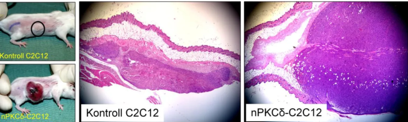 2. ábra Kontroll és az nPKCδ-t stabilan kifejező C2C12 mioblasztok által SCID egerekben indukált  tumorok 30 nappal az injektálás után 