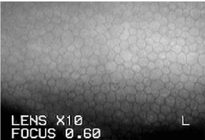 7. ábra. Normális szaruhártya endotheliumról készült felvétel, amelyen jól látszanak az  egyrétegű hexagonális sejtek