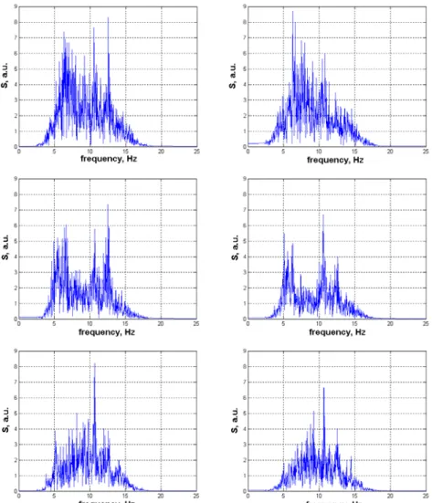 Figure 2.9. Power spectra of vertical displacement – time functions of the recordings shown in Figure 2.8