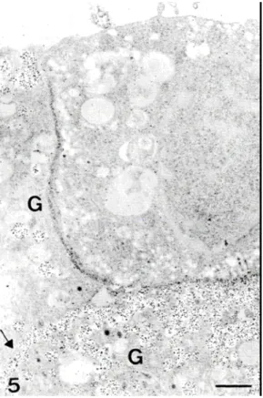 9. ábra Emberi adenohipfízisből készült  tenyészet. A két, immunaranyfestéssel  azonosított növekedési hormont termelő  sejt (G) szomszédos membránja jelöletlen, 