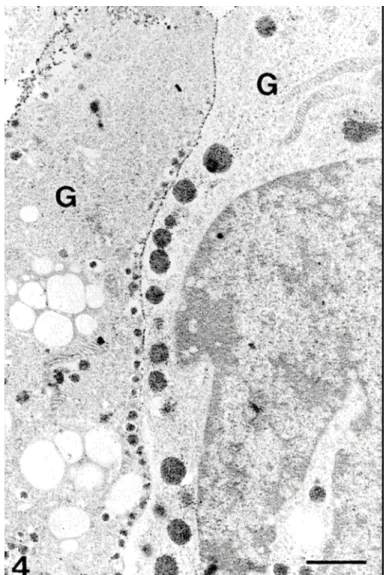 10. ábra Emberi adenohipfízisből készült tenyészet. Két különböző morfológiájú  immunaranyfestéssel azonosított növekedési hormont termelő sejt (G)
