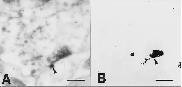 14. ábra Egér mediális habenula. A: Ca-piroantimonát szemcsék az idegvégződések  vezikuláiban (v, nyíl)