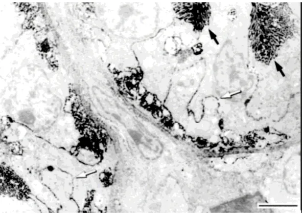 18. ábra Ekto-ATPáz enzim jelenléte vesetubulus sejtekben (sertésszövet). A  kefeszegélymembránon található csapadék mennyisége (fekete nyíl) igen nagy, de 