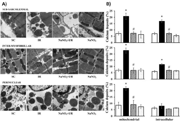 Figure 1. Representative images taken at 12000x magnification (A) and their quantitative analysis (B)  of calcium deposits obtained by transmission electron microscopy (TEM) in the sham-operated (SC,  n  =  4)  ischemic  control  (IR, n  =  4)  and  sodium
