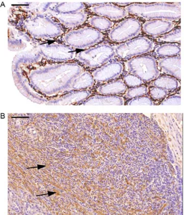 Figure  1.  Immunolocalization  and  morphological  rearrangement  of  tumor-associated MFs