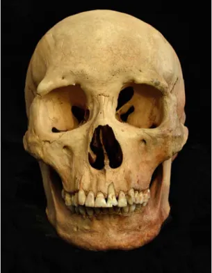 1. kép. 1. Szinid-x típusú koponya (Kunszállás–Fülöpjakab 59. sír, maturus férfi); 2. Belső-ázsiai típusú  koponya (Szatymaz–Makraszéki iskola 441