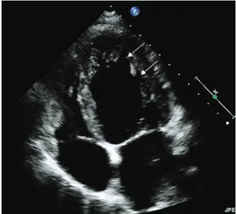 Fig. 6.1 Routine  2-dimensional  echocardiography  demonstrating 