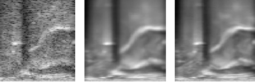 2. ábra: Egy szájüreg-ultrahangkép eredeti felvétele (balra), valamint az auto- auto-enkóder hálóval visszaállítva N = 64 (középen) és N = 512 (jobbra) neuront használva a bottleneck rétegben.
