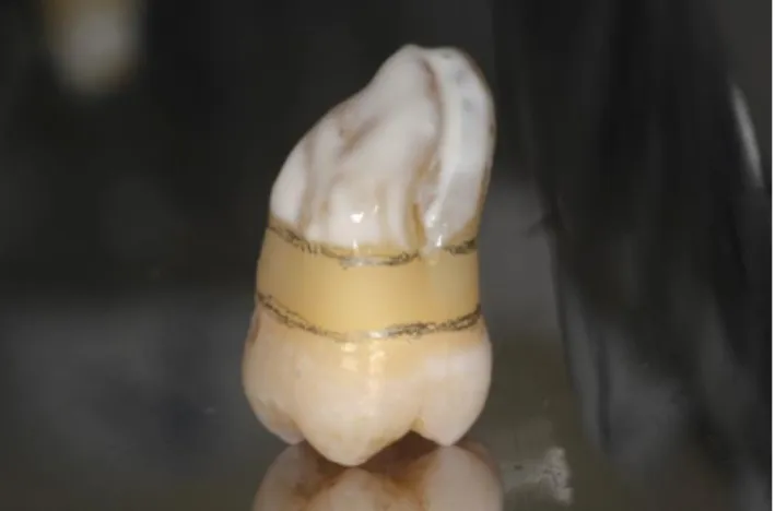 Figure 1.A layer of later separator applied on the root surface before embedding. 