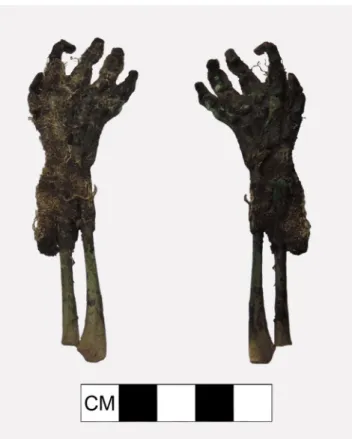 Fig. 3 Nyárlőrinc, ind. no. 14426, skeletal elements, mummified right forearm, and dorsum