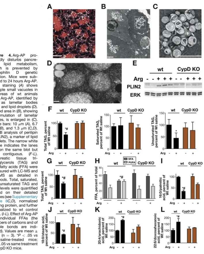 Figure 9). In correlation with improved CatB processing, cyclophilin D knockout normalized autophagic ﬂux in  Arg-AP, resulting in decreased levels of LC3-II, p62, and  ubiq-uitinated proteins (Figure 5D,E) and markedly less acinar cell vacuolization (Figu