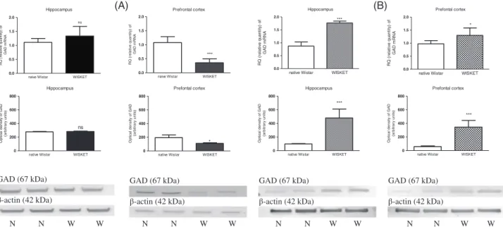 FIGURE 5 Results of RT-PCR and western immunoblotting experiments. The changes of mRNA and protein expressions of GAD1 in the hippocampal region and prefrontal cortex samples of male (A) and female (B) naive Wistar (N) and WISKET (W) rat brain