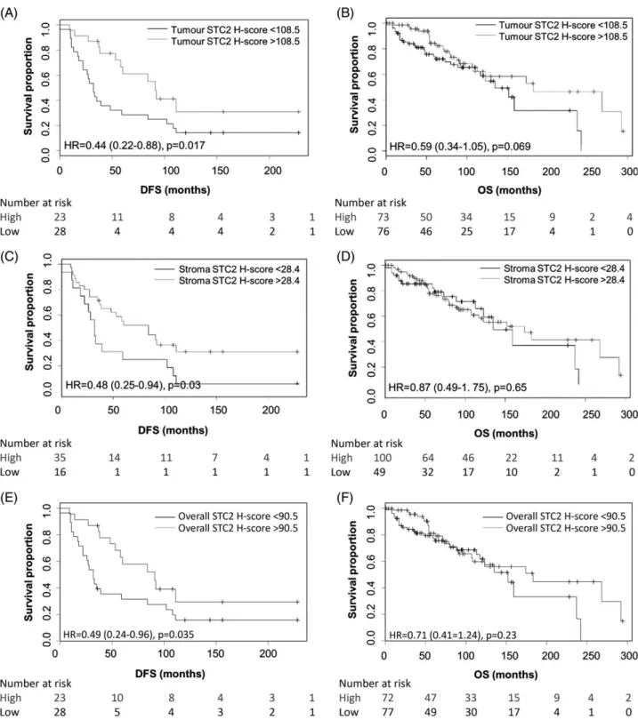 Figure 3. Kaplan – Meier survival curves showing impact of STC2 staining H-score in tumour and stroma on patient prognosis