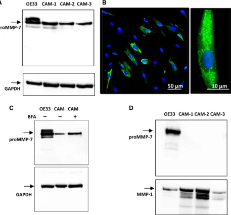 Figure 5. Expression of MMP-7 in myofibroblasts. (A) In cell extracts of three different CAM lines (CAM-1, -2 and -3) there was a band corresponding to proMMP-7 (28 kD) in western blots; in some cases, and in OE33 cells run as a positive control, there was