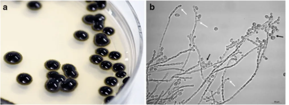 Fig. 2 Colony (a) and microscopic morphology (b) of Exophiala dermatitidis SZMC 21989 cultured on Sabouraud’s agar for 7 days.