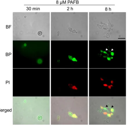 Figure 7.  Uptake of BODIPY-PAFB (8 µM) in N. crassa conidia or germlings. Samples were taken after 30 min,  2 h and 8 h and co-stained with PI for 10 min before imaging