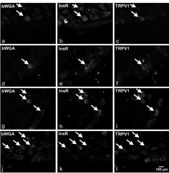 Fig. 1 Photomicrographs of biotin-conjugated wheat germ agglutinin (bWGA)-labelled primary sensory neurons innervating the dorsal hind paw skin (a, b, c), the gastrocnemius muscle (d, e, f), the pancreas (g, h, i) and the urinary bladder (j, k, l) showing 