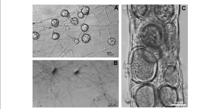 FIGURE 4 | Chlamydospores of the nematode parasitic and root endophytic hyphomycete Pochonia chlamydosporia showing their persistent cellular structure (A)
