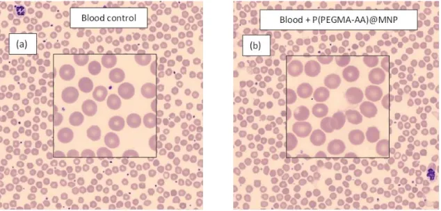 Figure  8.  Whole  blood  smears  from  the  sample  of  Donor  #1  without  (a)  and  with  (b)  P(PEGMA-AA)@MNP added at 0.4 mg/mL concentration