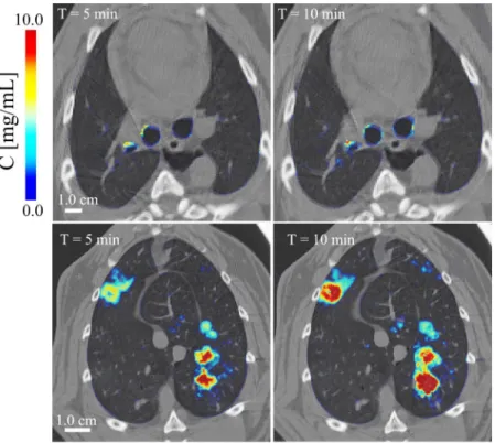 Figure 9.  Composite cross-sectional images showing lung morphology and iodine deposition in central  conducting airways (top) and in the lung periphery (bottom) after 5 and 10 min of aerosol inhalation, in one  control animal.