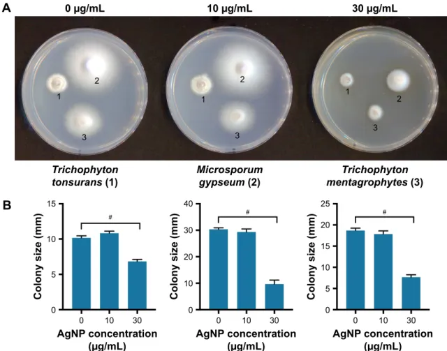 Figure 4 anti-dermatophyte activity of silver nanoparticles. (A) colonies of Trichophyton tonsurans (1), Microsporum gypseum (2) and Trichophyton mentagrophytes (3) on PDa  and PDa supplemented with different concentrations of agNP