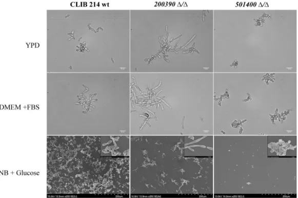 Figure 2.  Pseudohyphal growth of the C. parapsilosis mutant strains. DIC and SEM images of pseudohyphae  produced by the wild-type (CLIB 214) CPAR2_200390Δ/Δ and CPAR2_501400Δ/Δ strains 48 hours after  cultivation in YPD, FBS supplemented DMEM and YNB + g