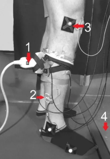 3. ábra. Vizsgálati eszközök elhelyezkedése egy vizsgálati személyen  1. Ultrahang 2. EMG elektródák 3