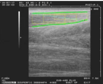 9. ábra. SMA szoftver által elemzett laterális gastrocnemiusról készült ultrahang képen  Zöld vonallal a szoftver által detektált alsó és felső apuneurosis látható