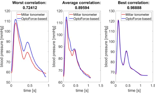 Figure 4.4: The averaged single-period signals of the worst (after exclusion of the 12 outliers), the best and an average correlated signal pair