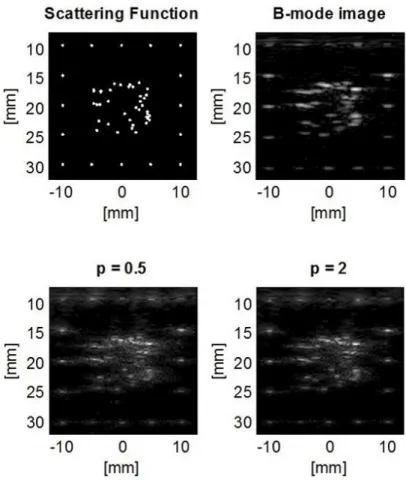 Figure 3. Scattering function of our phantom, the obtained B-mode image and two resulting images of the algorithms using p = 0.5 and p = 2 norm