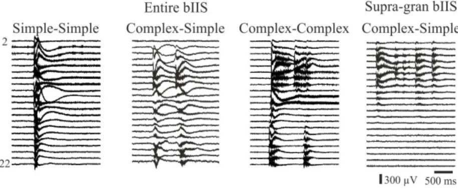 Figure 3: The complexity of bIISs. NoEpi slices generated only temporally and spatially simple (simple-simple) events which invaded the entire  neocor-tex