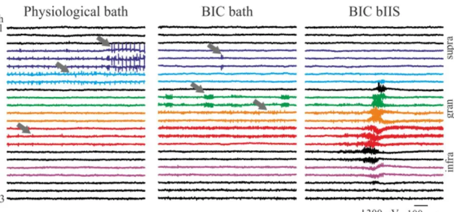 Figure 4: LFPg recordings of the same recording site in physiological solu- solu-tion, in bicuculline bath and the presence of a bIIS