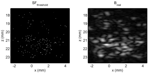 Figure 3.3 shows the estimated scattering function SF threshold aligned with the real ultrasound image