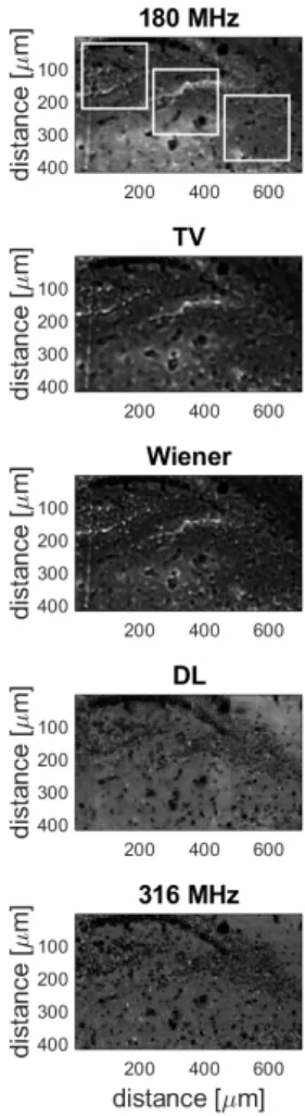Figure 2: Results of the different resolution enhancement methods on the test image. The images show a rat brain coronal section (Bregma -3.12, the dentate gyrus)