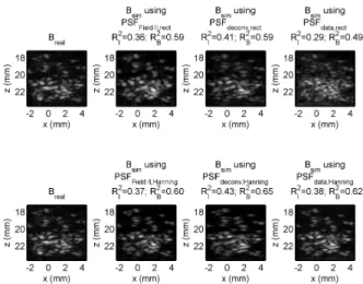 Figure 1: Comparison between the real ultrasound image (first col- col-umn) and simulated ultrasound images computed using six different estimates of the PSF