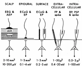 Figure 2: Brain electrode types; the figure shows the place of recording from scalp to intracellular level  (from left to right)