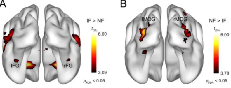 Figure 2. Results of the whole-brain random-effects analysis. Bilateral areas  of the fusiform gyrus showed significantly lower activation for noisy relative  to  intact  faces  (A),  while  larger  responses  to  noisy  than  intact  faces  were  found  b