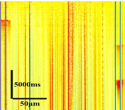 Figure 9. Representative Ca 2+  responses recorded by two-photon Ca 2+  imaging. 16 bulk loaded (OGB-1-AM, SR101)  human neocortical neuron/interneuron were selected by line scan for spontaneous recording, the scanning time were  20 s