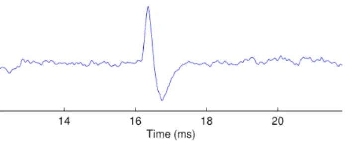 Fig. 1 - Typical recorded neural signal 