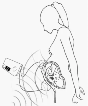 Figure 4.4: Sources of noise corrupting the low intensity fetal heart sound signal: noise from the mother (maternal heart and digestive sounds), noise from the fetus (hiccup, movements of the limbs) and noise from the environment