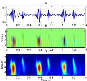 Figure 4.13: (A) A fPCG segment and the corresponding (B) time-scale representation using an 8 th order Gaussian mother wavelet